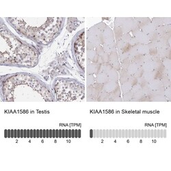 SPAG9 Antibody, Novus Biologicals:Antibodies:Primary Antibodies